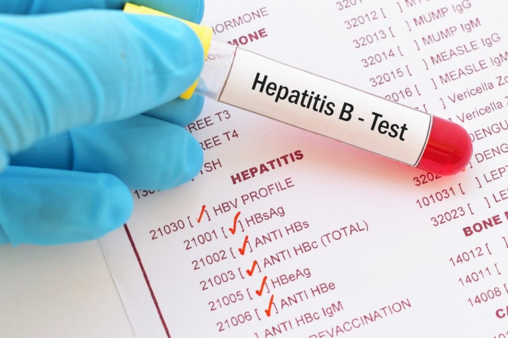 Hepatitis 1 1024x682 1