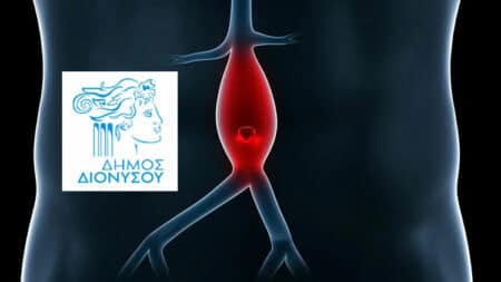 1 2 2 Δωρεάν εξέταση για ανεύρυσμα κοιλιακής αορτής από το Δήμο Διονύσου την Τετάρτη 1 και την Πέμπτη 2/3