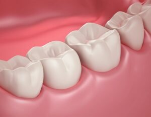 Νέα τεχνολογία πολυμερούς με αντιβακτηριακές ιδιότητες προλαμβάνει δευτερογενείς κοιλότητες