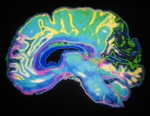 Νέα μοντέλα κατανόησης των αιτίων του chemo brain