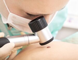 TROP2: Υποσχόμενος θεραπευτικός στόχος για τον καρκίνο του νεφρού