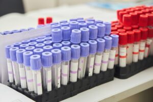 Γενετικοί παράγοντες και επιβίωση μετά τη διάγνωση