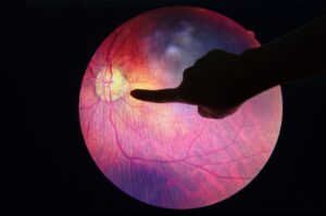 AI τεχνολογία για έλεγχο όρασης στους διαβητικούς