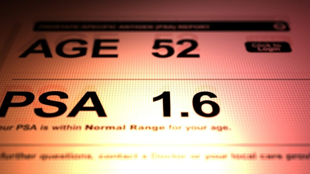 Μελέτη αποδεικνύει ότι η εξέταση PSA βελτιώνει την επιβίωση και την ασφάλεια