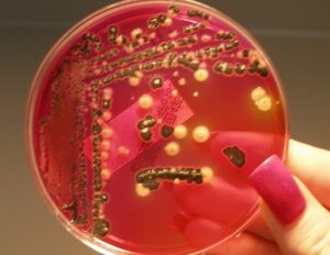 Επικύρωση του iQ-Check Enterobacteriaceae Kit της Bio-Rad για ανίχνευση Enterobacteriaceae σε βρεφικές τροφές