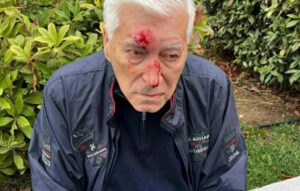Θεσσαλονίκη: 82χρονος καταγγέλλει ξυλοδαρμό από γιατρό στον δρόμο