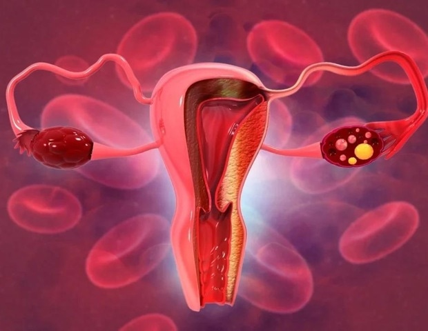 Παγκόσμια συνεργασία επιταχύνει την πρόοδο για την εξάλειψη του καρκίνου του τραχήλου της μήτρας