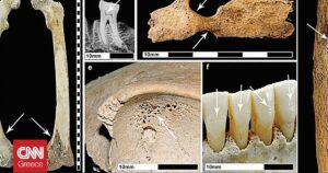Οι αρχαίοι Ρωμαίοι επηρέασαν αρνητικά την υγεία των Βρετανών