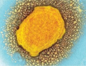 Νέα μέθοδος κατά της ευλογιάς των πιθήκων με τη βοήθεια της AI