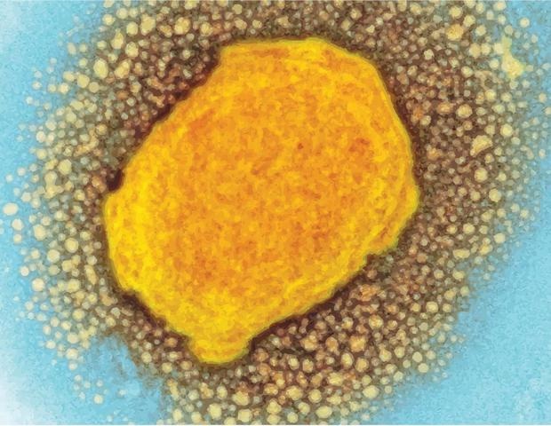 Νέα μέθοδος κατά της ευλογιάς των πιθήκων με τη βοήθεια της AI