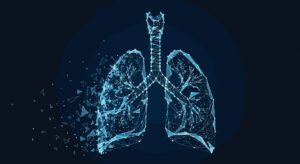 Νέα τεχνολογία τεχνητής πνευμονίας σώζει ασθενή μετά από αφαίρεση πνευμόνων