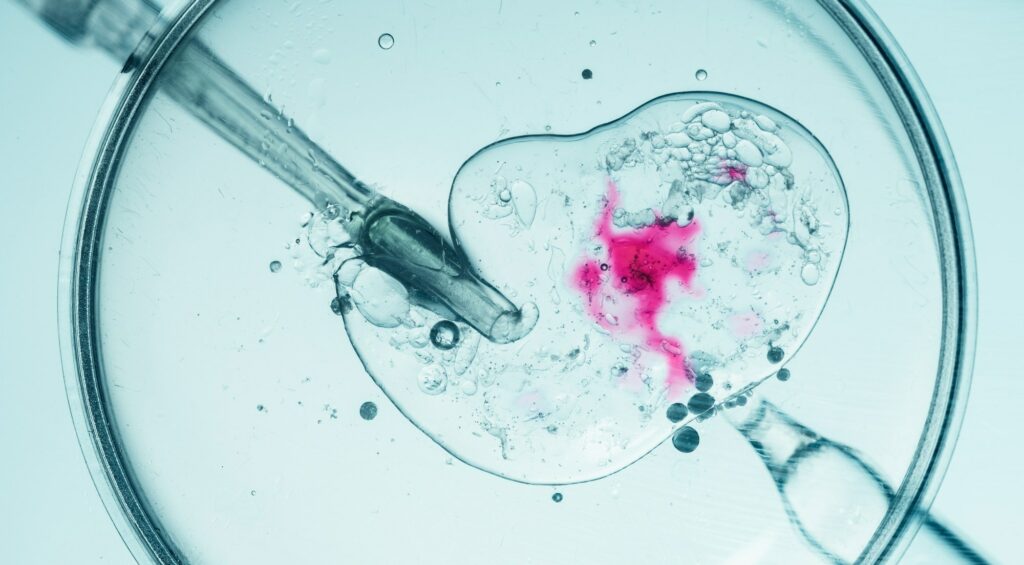 Νέα μελέτη IVF: Συντομότερη γονιμοποίηση προστατεύει τη διαθεσιμότητα εμβρύων