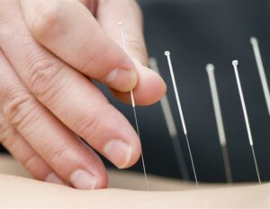 Η Ακupuncture ρυθμίζει τη λειτουργία του ανοσοποιητικού μέσω συγκεκριμένων νευρικών κυκλωμάτων