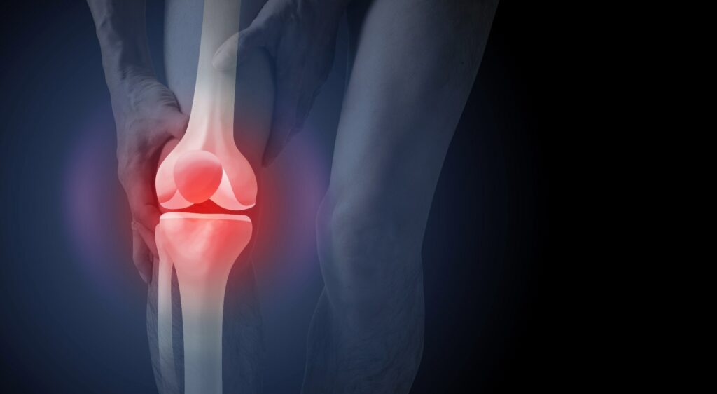 Σύνδεση της κατανάλωσης υπεξεργασμένων τροφίμων με τη μειωμένη ποιότητα μυών του μηρού