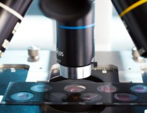 Μελέτη αποκαλύπτει τη χολή ως δεξαμενή μικροπλαστικών στον ανθρώπινο οργανισμό