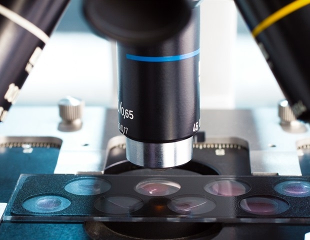 Μελέτη αποκαλύπτει τη χολή ως δεξαμενή μικροπλαστικών στον ανθρώπινο οργανισμό